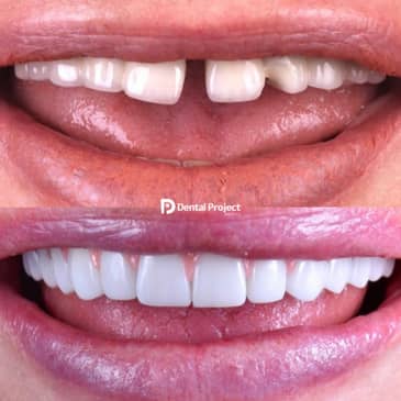 Slider image (5) Dental Project Mexico